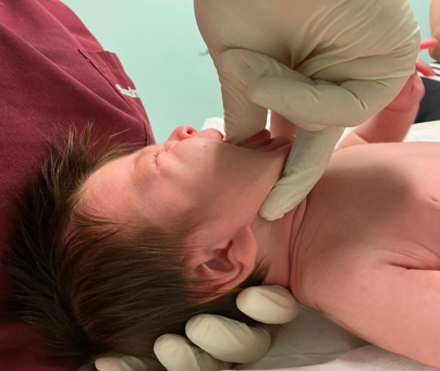 fisioterapia en pediatría succión, deglución, respiración en Fisiocyl Valladolid