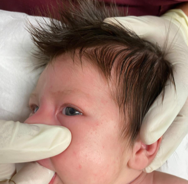 curso fisioterapia pediatria niños